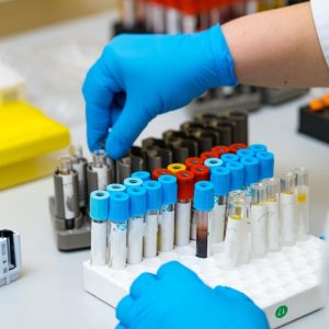 Estudio Genético Déficit DAO