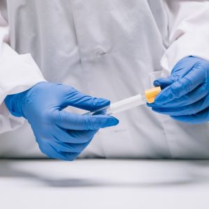 Prueba Elastasa Pancreática heces