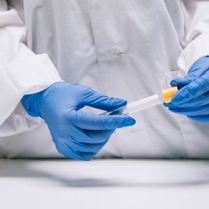 Test Genético para Autismo