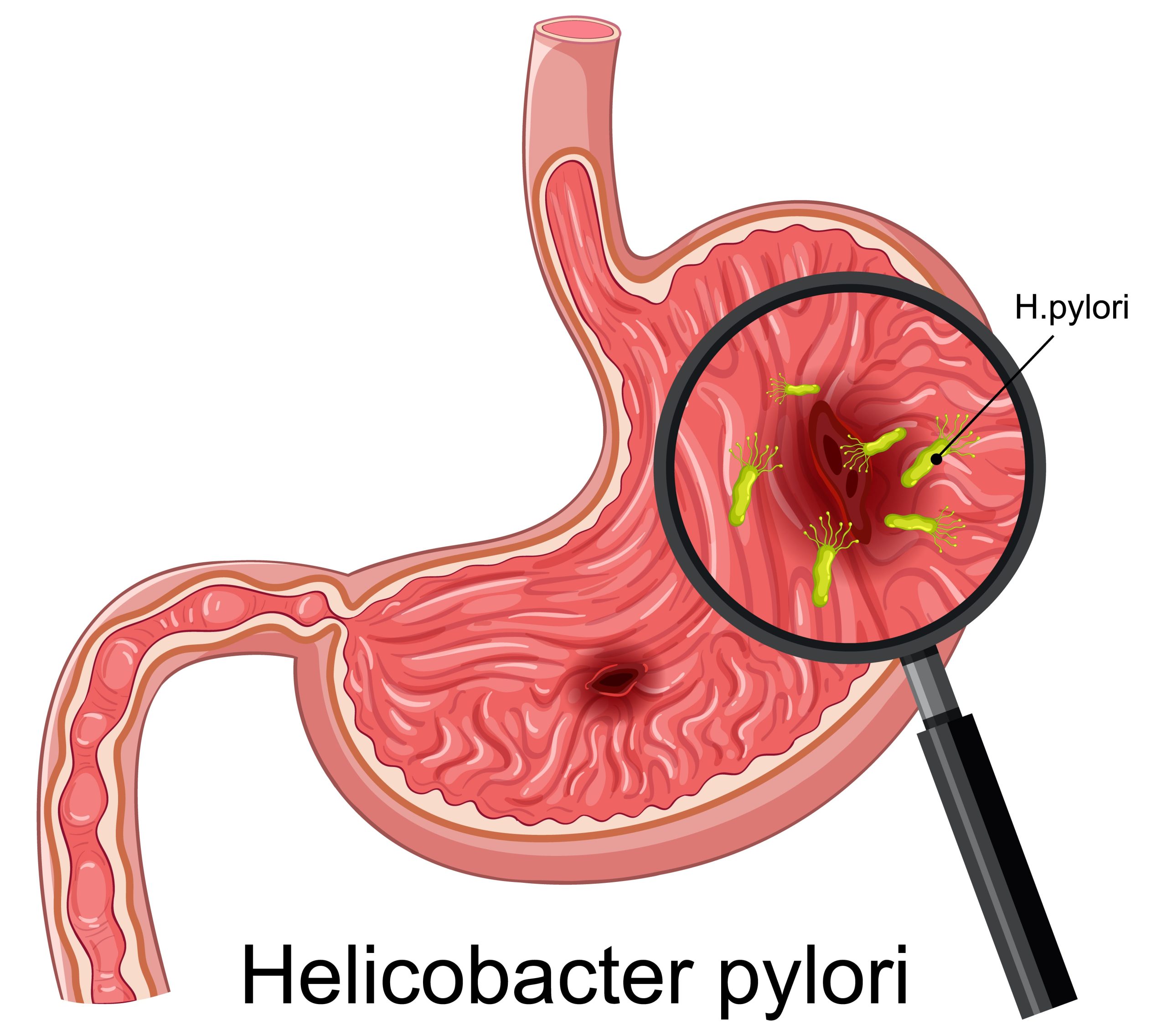 bacteria Helicobacter Pylori