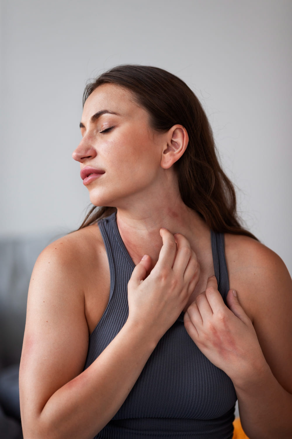 dermatitis seborreica remedios