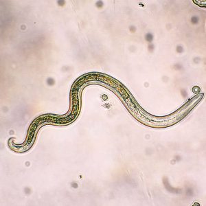 Estudio fecal molecular de parásitos