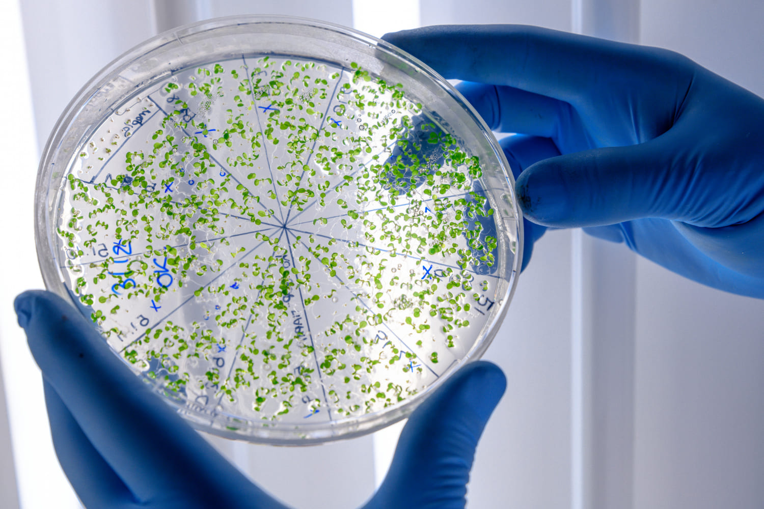 sintomas e coli